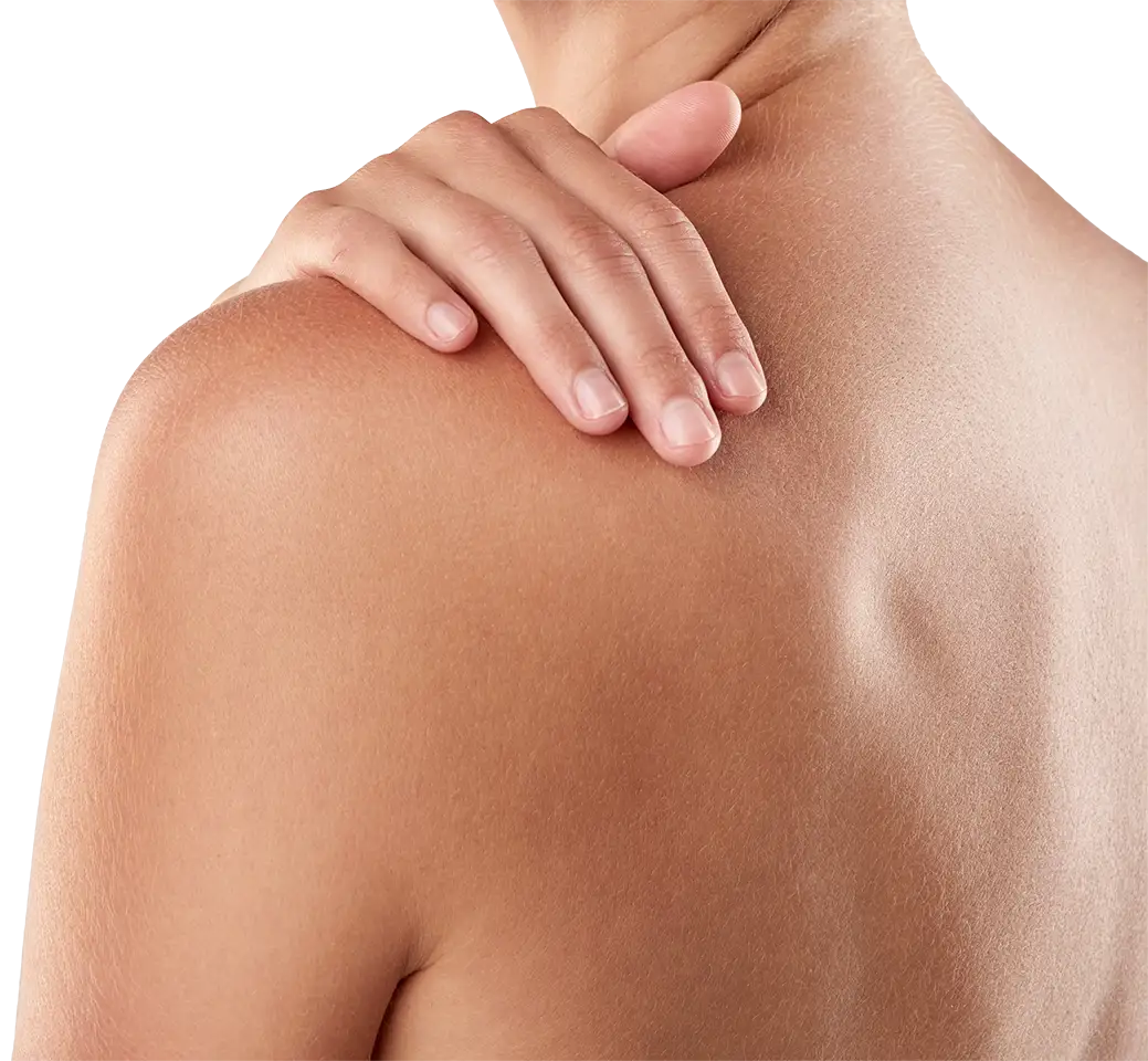Cosmetic Lesion Excision Cosmetic Lesion Excision